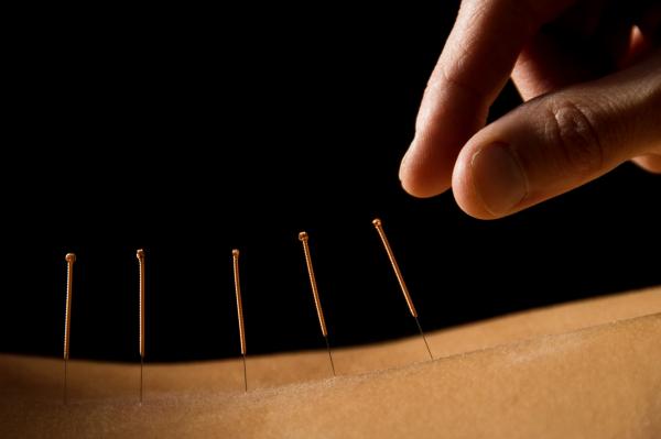 UK no longer recommends acupuncture for back pain; will Australia be next?